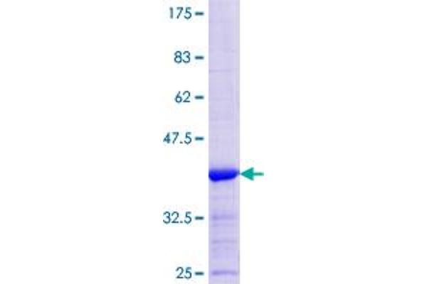 Ladinin 1 Protein (LAD1) (AA 418-517) (GST tag)