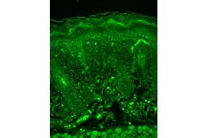 Immunohistochemistry analysis using Mouse Anti-Rhodopsin Monoclonal Antibody, Clone 1D4 (ABIN863084 and ABIN863085). (Rhodopsin antibody)