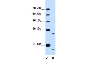 WB Suggested Anti-CCPG1 Antibody Titration:  0. (CCPG1 antibody  (Middle Region))