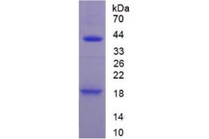 SDS-PAGE analysis of Mouse IL1R1 Protein.