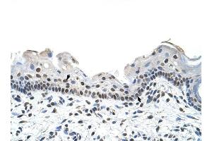 RBM28 antibody was used for immunohistochemistry at a concentration of 4-8 ug/ml to stain Squamous epithelial cells (arrows) in Human Skin. (RBM28 antibody  (C-Term))