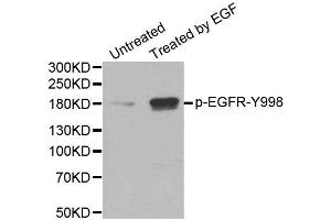 Western Blotting (WB) image for anti-Epidermal Growth Factor Receptor (EGFR) (pTyr1016) antibody (ABIN1870114) (EGFR antibody  (pTyr1016))