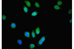 Immunofluorescent analysis of A549 cells using ABIN7159025 at dilution of 1:100 and Alexa Fluor 488-congugated AffiniPure Goat Anti-Rabbit IgG(H+L) (SPG21 antibody  (AA 1-308))