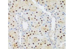 Immunohistochemistry of paraffin-embedded Rat kidney using STAT4 Polyclonal Antibody at dilution of 1:100 (40x lens). (STAT4 antibody)