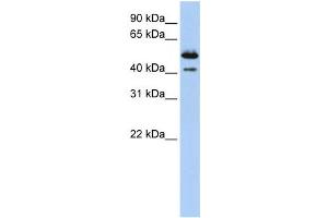 Western Blotting (WB) image for anti-Deoxyribonuclease II beta (DNASE2B) antibody (ABIN2458670)