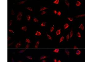 Immunofluorescence analysis of L929 cells using NEDD1 Polyclonal Antibody at dilution of 1:100.