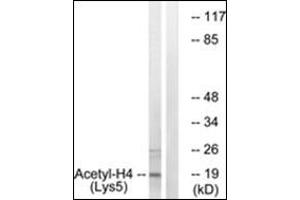 Western blot analysis of extracts from COS7 cells, treated with TSA 400nM 24h, using Histone H4 (Acetyl-Lys5) Antibody. (Histone H4 antibody  (acLys5))