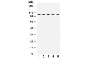 Western blot testing of 1) rat testis, 2) rat ovary, 3) human SKOV, 4) COLO320 and 5) human HeLa lysate with TRIM28 antibody. (KAP1 antibody  (AA 699-835))