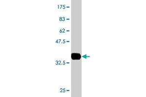 Western Blot detection against Immunogen (36. (EPM2AIP1 antibody  (AA 508-606))