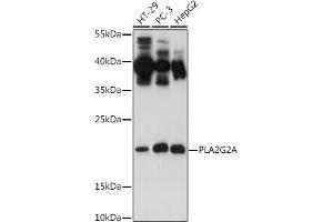 Western blot analysis of extracts of various cell lines, using PLG2A antibody (ABIN3021801, ABIN3021802, ABIN3021803 and ABIN6215942) at 1:500 dilution. (PLA2G2A antibody  (AA 21-144))