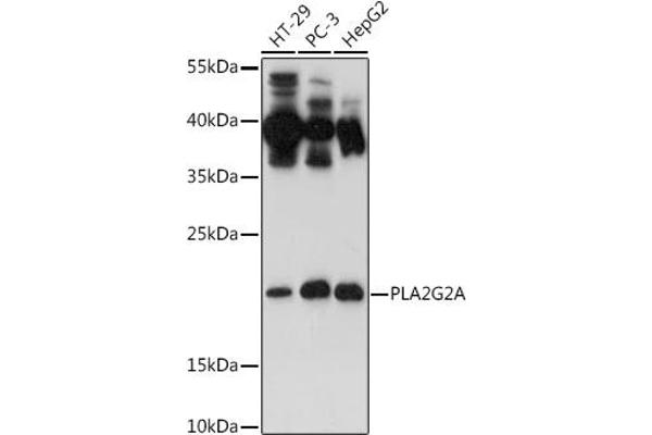 PLA2G2A anticorps  (AA 21-144)