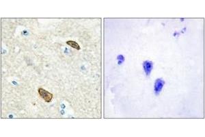 Immunohistochemistry analysis of paraffin-embedded human brain, using PLXDC1 Antibody. (PLXDC1 antibody  (AA 71-120))