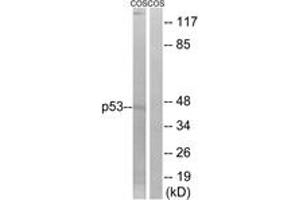 Western blot analysis of extracts from COS7 cells, treated with UV, using p53 (Ab-9) Antibody. (p53 antibody  (AA 8-57))