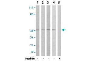Western blot analysis of extracts from COLO cells (Lane 1 and 5), HT-29 cells (Lane 2), A-549 cells (Lane 3) and 293 cells (Lane 4), using IL13RA1 polyclonal antibody .