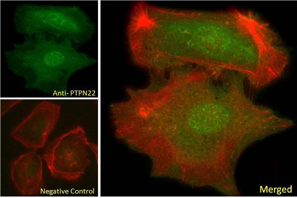 PTPN22 antibody  (Internal Region)