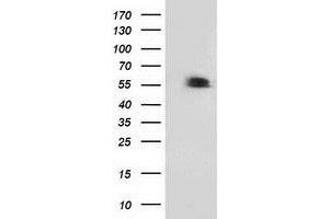 HEK293T cells were transfected with the pCMV6-ENTRY control (Left lane) or pCMV6-ENTRY TP53 (Right lane) cDNA for 48 hrs and lysed. (p53 antibody)