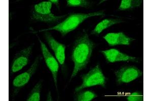 Immunofluorescence of monoclonal antibody to WDR42A on HeLa cell. (DCAF8 antibody  (AA 1-273))
