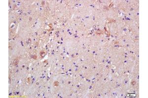 Formalin-fixed and paraffin embedded rat brain labeled with Rabbit Anti CKMT/Creatine kinase MT Polyclonal Antibody, Unconjugated (ABIN717536) at 1:200 followed by conjugation to the secondary antibody and DAB staining (CKMT1B antibody  (AA 115-220))