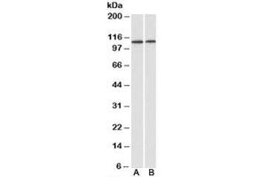 Western blot testing of human heart [A] and kidney [B] lysates with BMP antibody at 1ug/ml. (BMP antibody)