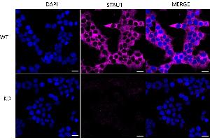 Immunocytochemical staining of Hela cells using STAU1 antibody (ABIN7800434), 1:1,000), Top panel: wild-type (WT), Bottom panal: STAU1 shRNA knockdown (KD).