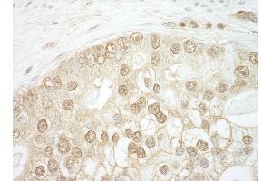 Immunohistochemistry (IHC) image for anti-CCR4-NOT Transcription Complex, Subunit 2 (CNOT2) (AA 490-540) antibody (ABIN7454458)