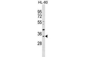 SULT1B1 Antibody (C-term) western blot analysis in HL-60 cell line lysates (35µg/lane). (SULT1B1 antibody  (C-Term))
