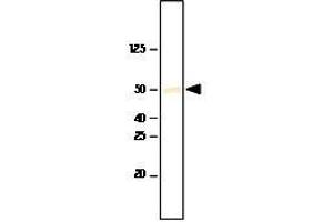 Recombinant SET7/9 was resolved by electrophoresis, transferred to PVDF membrane and probed with anti-SET7/9(1:1,000). (SET7/9 antibody  (AA 1-366))