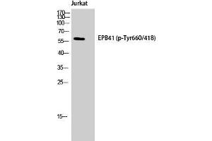 Western Blot (WB) analysis of Jurkat cells using Phospho-4. (EPB41 antibody  (pTyr660))