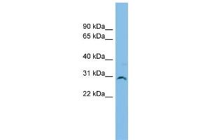 WB Suggested Anti-SNF8 Antibody Titration: 0. (SNF8 antibody  (Middle Region))