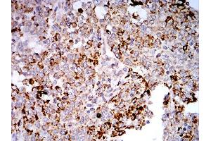 Immunohistochemistry (IHC) image for anti-Toll-Like Receptor 9 (TLR9) (AA 868-1016) antibody (ABIN5896728) (TLR9 antibody  (AA 868-1016))