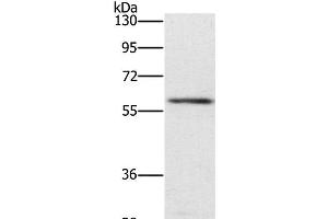 Western Blot analysis of Mouse spleen tissue using TRAFD1 Polyclonal Antibody at dilution of 1:400 (TRAFD1 antibody)