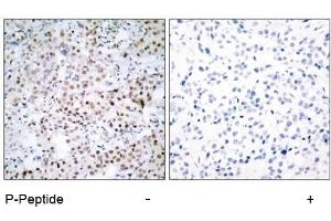 Image no. 1 for anti-cAMP Responsive Element Binding Protein 1 (CREB1) (pSer133) antibody (ABIN196704) (CREB1 antibody  (pSer133))