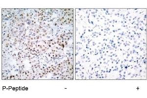 Image no. 1 for anti-cAMP Responsive Element Binding Protein 1 (CREB1) (pSer133) antibody (ABIN196704)