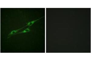 Immunofluorescence analysis of NIH-3T3 cells, using IL-13R/CD213 alpha1 (Ab-405) Antibody. (CD213alpha1 (AA 371-420) antibody)