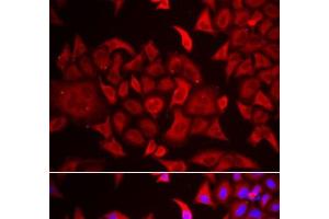 Immunofluorescence analysis of HeLa cells using TARS Polyclonal Antibody (TARS antibody)