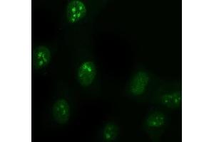 IF analysis of DDX1 using anti-DDX1 antibody (ABIN7602052). (DDX1 antibody  (AA 562-740))