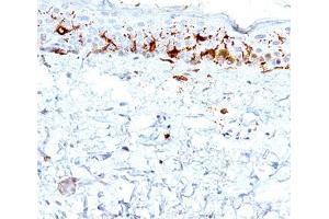 IHC testing of human skin stained with CD1a antibody (C1A/711). (CD1a antibody)
