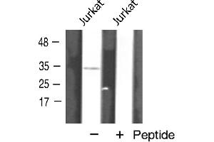 Western blot analysis of AQP12 expression in Jurkat cells (Aquaporin 12A antibody  (C-Term))