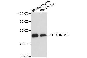 Western blot analysis of extracts of various cell lines, using SERPINB13 antibody (ABIN6292723) at 1:3000 dilution.
