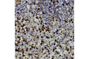 Immunohistochemistry of paraffin-embedded mouse spleen using CD11b/ITGAM antibody (ABIN3022179, ABIN3022180, ABIN3022181 and ABIN6218650) at dilution of 1:100 (40x lens).