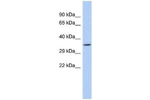 WB Suggested Anti-SIRT4 Antibody Titration:  0. (SIRT4 antibody  (N-Term))