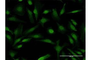 Immunofluorescence of monoclonal antibody to COMMD1 on HeLa cell. (COMMD1 antibody  (AA 1-190))