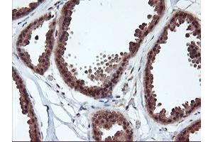 Immunohistochemical staining of paraffin-embedded Human breast tissue using anti-RABL2A mouse monoclonal antibody.