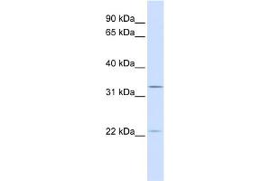 WB Suggested Anti-BRI3BP Antibody Titration:  0. (BRI3BP antibody  (C-Term))