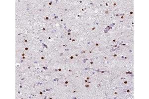 ABIN6266528 at 1/200 staining human brain tissue sections by IHC-P. (POLB antibody  (C-Term))