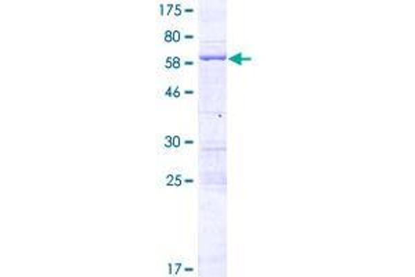 FSD1L Protein (AA 1-311) (GST tag)