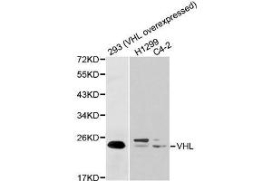 Western blot analysis of extracts of various cell lines, using VHL antibody. (VHL antibody  (AA 1-172))