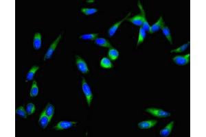 Immunofluorescent analysis of Hela cells using ABIN7149558 at dilution of 1:100 and Alexa Fluor 488-congugated AffiniPure Goat Anti-Rabbit IgG(H+L) (DAPK3 antibody  (AA 283-401))