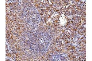 anti-CD70 Molecule (CD70) (AA 36-191) antibody