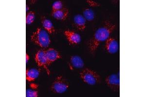 IF analysis of Glutathione Reductase using anti-Glutathione Reductase antibody (ABIN5693151). (Glutathione Reductase antibody  (AA 256-522))